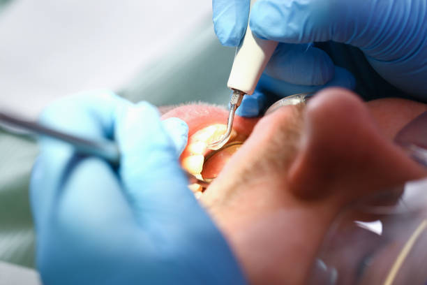 Best Emergency Gum Treatment in Landen, OH