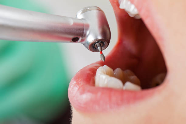 Best Pediatric Emergency Dentist in Landen, OH